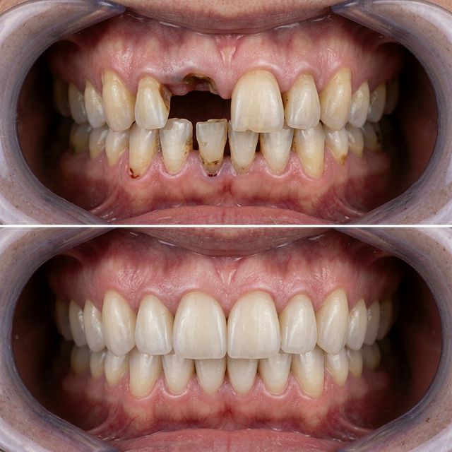 Real Patient Result 6