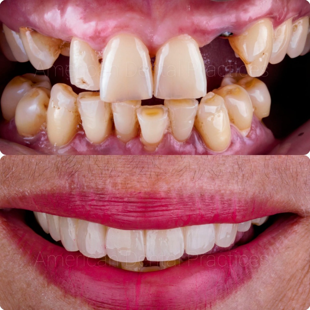 Real Patient Result 1